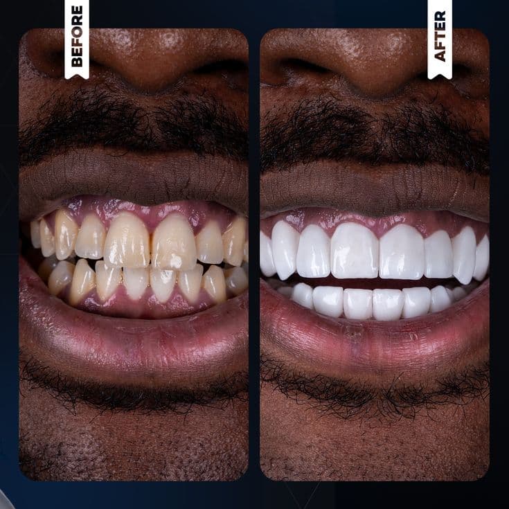 COSMETIC WHITENING
